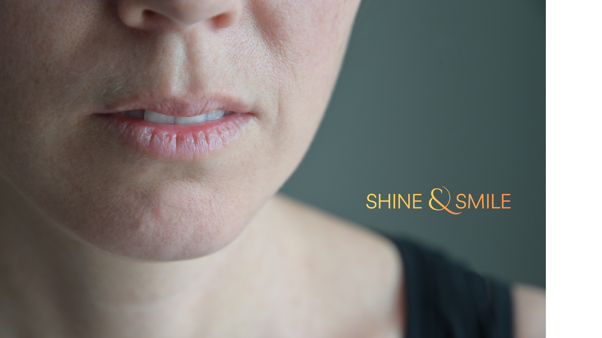 Ağız kuruluğu tedavisi İzmir Bayraklı - Diş hekimi